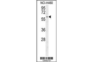 Western Blotting (WB) image for anti-Dynein, Cytoplasmic 1, Light Intermediate Chain 2 (DYNC1LI2) antibody (ABIN2158614)