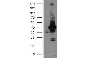 Image no. 4 for anti-Uracil-DNA Glycosylase (UNG) antibody (ABIN1501681)