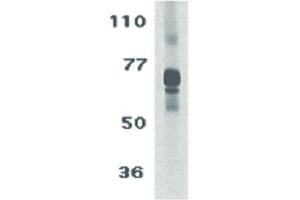 Image no. 1 for anti-Interleukin 27 Receptor, alpha (IL27RA) (C-Term) antibody (ABIN6655154)