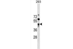 Image no. 1 for anti-Zinc Finger and BTB Domain Containing 32 (ZBTB32) (AA 96-125) antibody (APC) (ABIN1949415)
