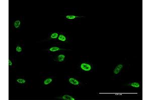 Immunofluorescence of monoclonal antibody to FOXP2 on HeLa cell.