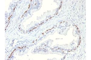 Image no. 3 for anti-Tumor Protein P63 (TP63) antibody (ABIN6940964)