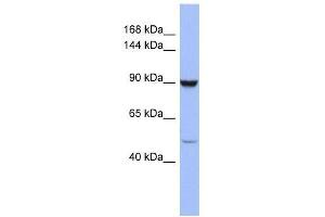 Image no. 1 for anti-Zinc Finger Protein 28 (ZFP28) (Middle Region) antibody (ABIN927806)