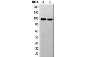 Western blot analysis of c-FER expression in Jurkat (A), HeLa (B) whole cell lysates.