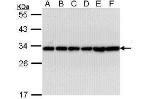 Image no. 1 for anti-14-3-3 alpha + beta (YWHAB) (Center) antibody (ABIN2856888)