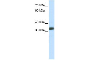 Image no. 1 for anti-SAP30 Binding Protein (SAP30BP) (C-Term) antibody (ABIN2775713)