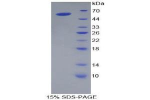 Image no. 1 for Apolipoprotein A-I (APOA1) (AA 25-265) protein (His tag,GST tag) (ABIN1879875)