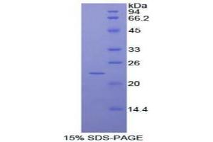 Image no. 1 for RAD54-Like 2 (RAD54L2) protein (ABIN3011420)