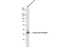 Image no. 3 for anti-Adiponectin Receptor 1 (ADIPOR1) (C-Term) antibody (ABIN2855945)