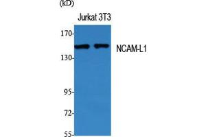 Image no. 2 for anti-L1 Cell Adhesion Molecule (L1CAM) (Ser727) antibody (ABIN3185776)