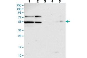 Image no. 1 for anti-KAT8 Regulatory NSL Complex Subunit 2 (KANSL2) antibody (ABIN5581431)
