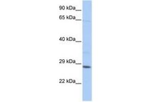 Image no. 1 for anti-TGFB-Induced Factor Homeobox 2-Like, X-Linked (TGIF2LX) (C-Term) antibody (ABIN6742653)