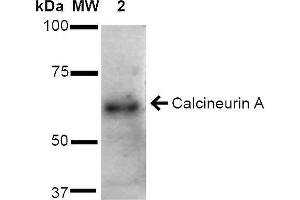 Image no. 3 for anti-Calcineurin A (CAN) (AA 264-283) antibody (FITC) (ABIN2481985)