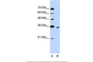Image no. 1 for anti-2,4-Dienoyl CoA Reductase 2, Peroxisomal (DECR2) (N-Term) antibody (ABIN320805)