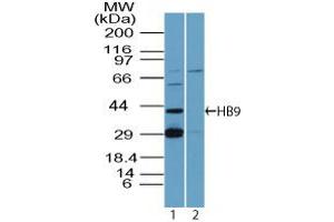Image no. 1 for anti-Motor Neuron and Pancreas Homeobox 1 (MNX1) antibody (ABIN6657592)