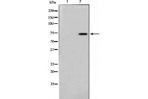 Image no. 1 for anti-Forkhead Box O1 (FOXO1) (pSer256) antibody (ABIN6255137)