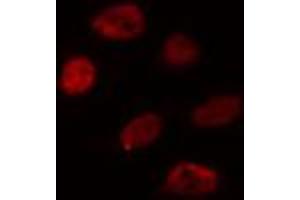 Image no. 3 for anti-Wilms Tumor 1 Associated Protein (WTAP) (C-Term) antibody (ABIN6257553)