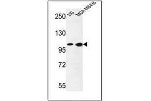 Image no. 3 for anti-Nuclear Receptor Coactivator 7 (NCOA7) (AA 82-112), (N-Term) antibody (ABIN953618)