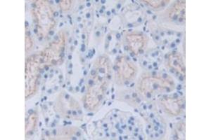 Image no. 2 for anti-Bone Marrow Stromal Cell Antigen 1 (BST1) (AA 41-300) antibody (ABIN1858175)