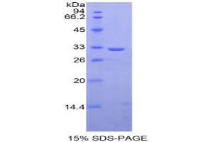 Image no. 1 for Signal Transducer and Activator of Transcription 1, 91kDa (STAT1) protein (ABIN3011656)