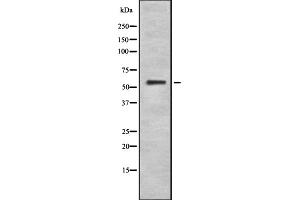 Image no. 1 for anti-Cytochrome P450, Family 4, Subfamily F, Polypeptide 2 (CYP4F2) (N-Term) antibody (ABIN6261173)