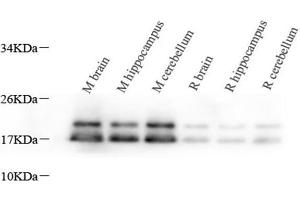 Western Blot analysis of various samples using MBP Polyclonal Antibody at dilution of 1:1000.