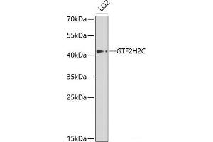GTF2H2C antibody