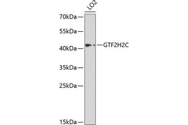 GTF2H2C antibody