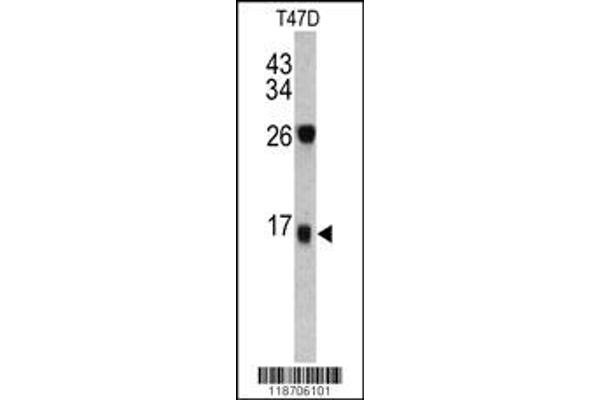 anti-Dermcidin (DCD) antibody