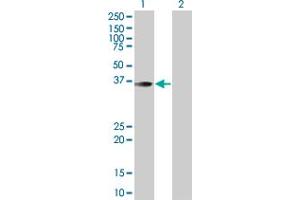 Image no. 1 for anti-Myocyte Enhancer Factor 2B (MEF2B) (AA 1-365) antibody (ABIN517824)
