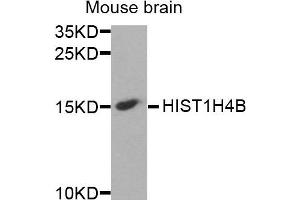 Image no. 1 for anti-Histone Cluster 1, H4b (HIST1H4B) antibody (ABIN2736896)