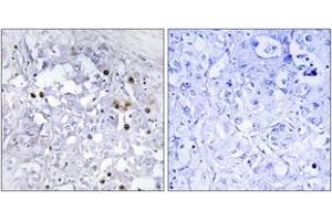 Image no. 2 for anti-Hepatocyte Nuclear Factor 4, alpha (HNF4A) (AA 280-329), (pSer313) antibody (ABIN1531864)