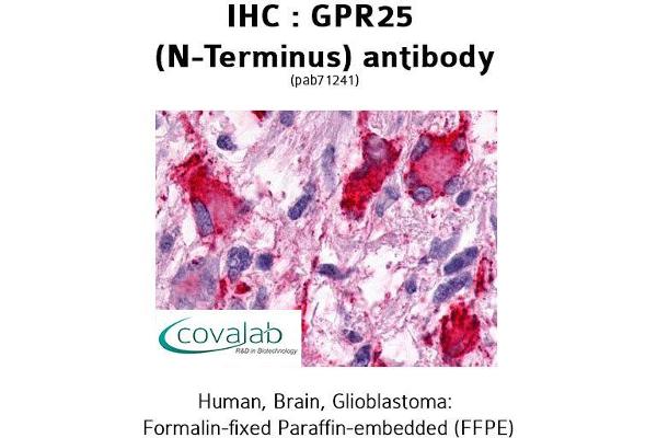 anti-G Protein-Coupled Receptor 25 (GPR25) (Extracellular Domain), (N-Term) antibody