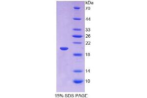 Image no. 1 for Insulin-Like Growth Factor Binding Protein 2, 36kDa (IGFBP2) (AA 148-325) protein (His tag) (ABIN6236544)