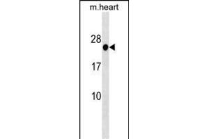HOXB7 Antibody (Center) (ABIN1538701 and ABIN2838284) western blot analysis in mouse heart tissue lysates (35 μg/lane).