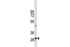 Image no. 2 for anti-Tryptase alpha/beta 1 (TPSAB1) (AA 249-275) antibody (ABIN3029273)