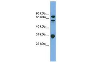 Image no. 1 for anti-SH3-Domain Kinase Binding Protein 1 (SH3KBP1) (AA 107-156) antibody (ABIN6745063)