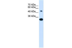 Image no. 1 for anti-Solute Carrier Family 2 (Facilitated Glucose/fructose Transporter), Member 5 (SLC2A5) (Middle Region) antibody (ABIN2777140)