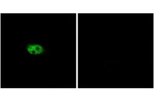 Image no. 2 for anti-Tachykinin Receptor 3 (TACR3) (AA 401-450) antibody (ABIN1535785)
