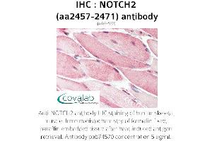 Image no. 1 for anti-Notch 2 (NOTCH2) (AA 2457-2471) antibody (ABIN1737435)