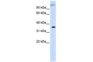 Image no. 1 for anti-Dihydrodiol Dehydrogenase (Dimeric) (DHDH) (AA 252-301) antibody (ABIN6741277)