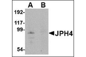 Image no. 1 for anti-Junctophilin 4 (JPH4) (Middle Region) antibody (ABIN500106)