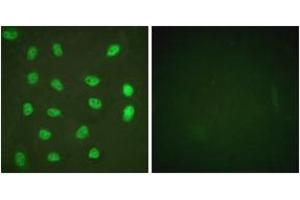 Immunofluorescence analysis of HeLa cells treated with PMA 125ng/ml 30', using MEF2A (Phospho-Ser408) Antibody.