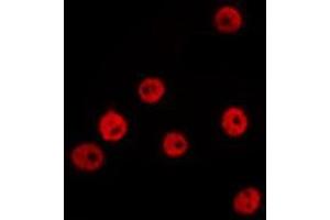 Image no. 2 for anti-Zinc Finger E-Box Binding Homeobox 1 (ZEB1) antibody (ABIN6266096)