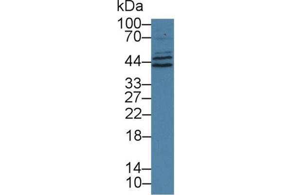 VPS37A 抗体  (AA 1-397)