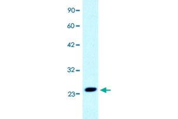 anti-MYST/Esa1-Associated Factor 6 (MEAF6) (N-Term) antibody