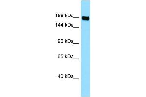 WB Suggested Anti-PLXNB3 Antibody Titration: 1.