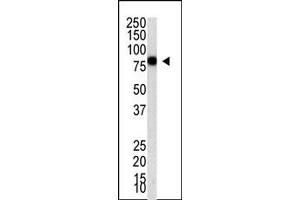 Image no. 1 for anti-Protein Inhibitor of Activated STAT, 4 (PIAS4) (C-Term) antibody (ABIN356771)