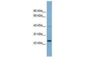 Image no. 1 for anti-Nucleolar Protein 16 (NOP16) (Middle Region) antibody (ABIN631833)