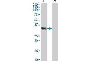 Image no. 1 for anti-Unc-119 Homolog (UNC119) (AA 1-240) antibody (ABIN563937)
